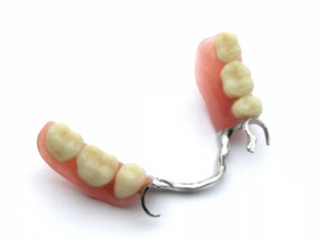 Partial-Dentures-Dentist-Miami-3